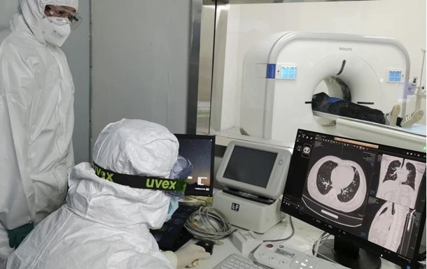 Ученые назвали возможную причину тяжелых случаев COVID-19 у молодых