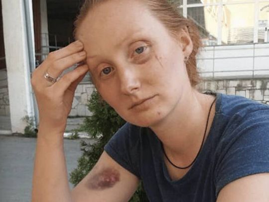 Колишній есбеушник п’яним побив поліцейську в Мукачево — суд його виправдав