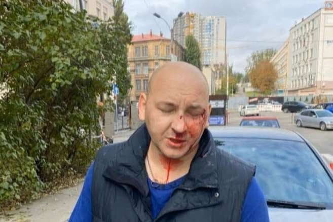 «Підключали дроти до очей, зубів, геніталій, на морозі голого обливали водою»: розвідник про тортури бойовиків «ЛНР»