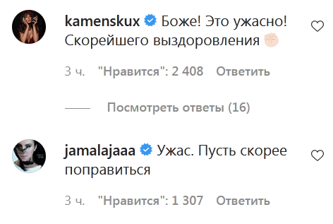 Зробили трепанацію черепа: танцюриста Наді Дорофєєвої жорстоко побили в Києві