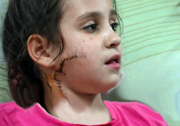 На блокпосте в Запорожской области расстреляли авто: ранена 11-летняя девочка