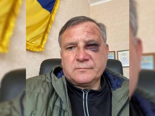 «Катували, щоб дістати інформацію про підрозділи ЗСУ в тилу»: староста з Чернігівщини розповів про полон