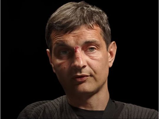 Звільнений з полону «азовець» Діанов передасть 23,4 млн грн на лікування побратимів: морпіх пояснив, звідки у нього такі гроші