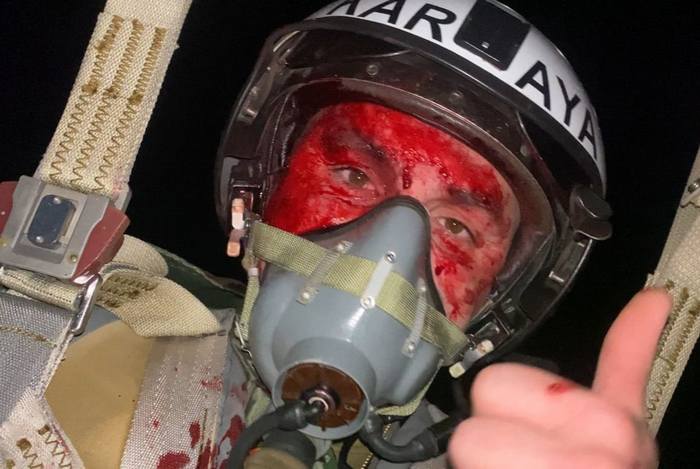 Закривавлене обличчя — важка ціна нашої перемоги: нагородили легендарного льотчика, який відвів палаючий літак від селища на Вінниччині та знищив 5 «Шахедів»