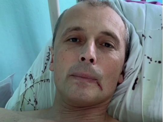 Колаборант з Мелітополя, якого ледь не «задвухсотили», публічно поскаржився на лікування у Криму