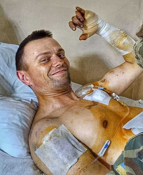 «Кожна клітина мого організму опинилась на електричному стільці»: киянин, який втратив на війні ногу й руку, пройде випробування заради сина