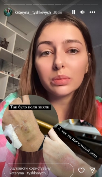 «Довелося лягти в психіатричну лікарню»: Катерина Тишкевич розповіла про причину різкого погіршення її стану