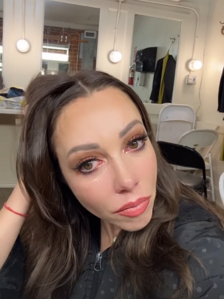 «Болісно це казати»: Катерина Кухар отримала серйозну травму