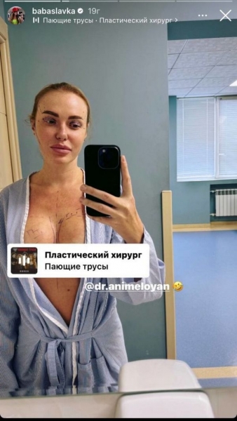 Слава Камінська знову лягла під ніж пластичного хірурга