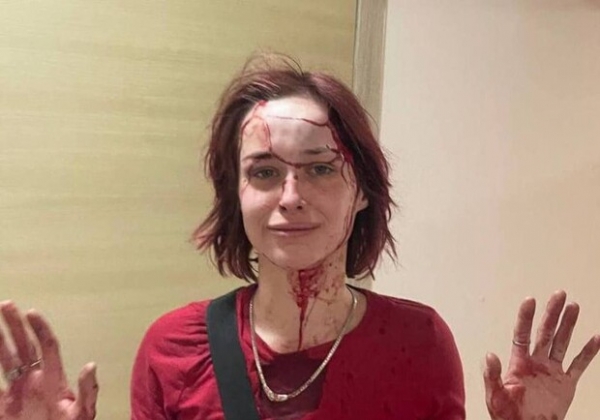 Вела себя агрессивно: в полиции прокомментировали избиение девушки в Одессе