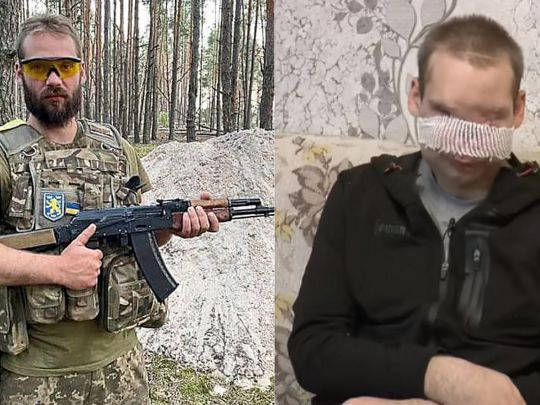 «Майже всі лікарі відмовились від нього»: після важкого поранення голови та обличчя українець хоче присвятити себе допомозі іншим