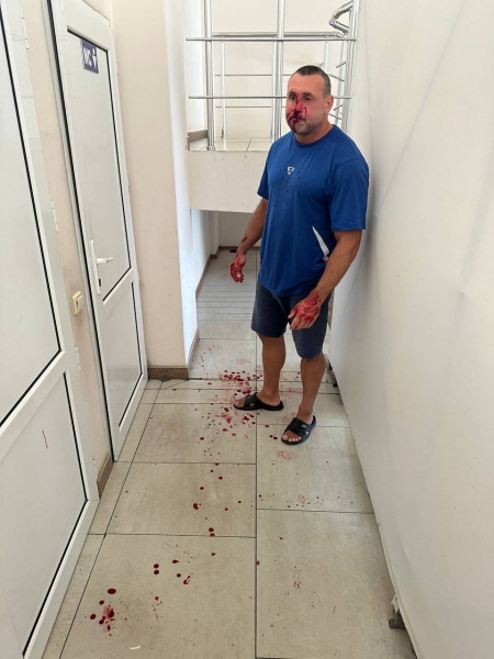 В Одесі фітнес-тренер образив військового та розплатився за це кров'ю (фото, відео 18+)