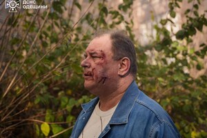 Десять погибших, более 40 раненых: что известно о пострадавших от ракетного удара по Одессе 