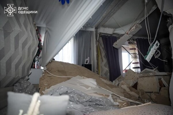 В Одессе из-за возгорания стиральной машинки пострадал мальчик
